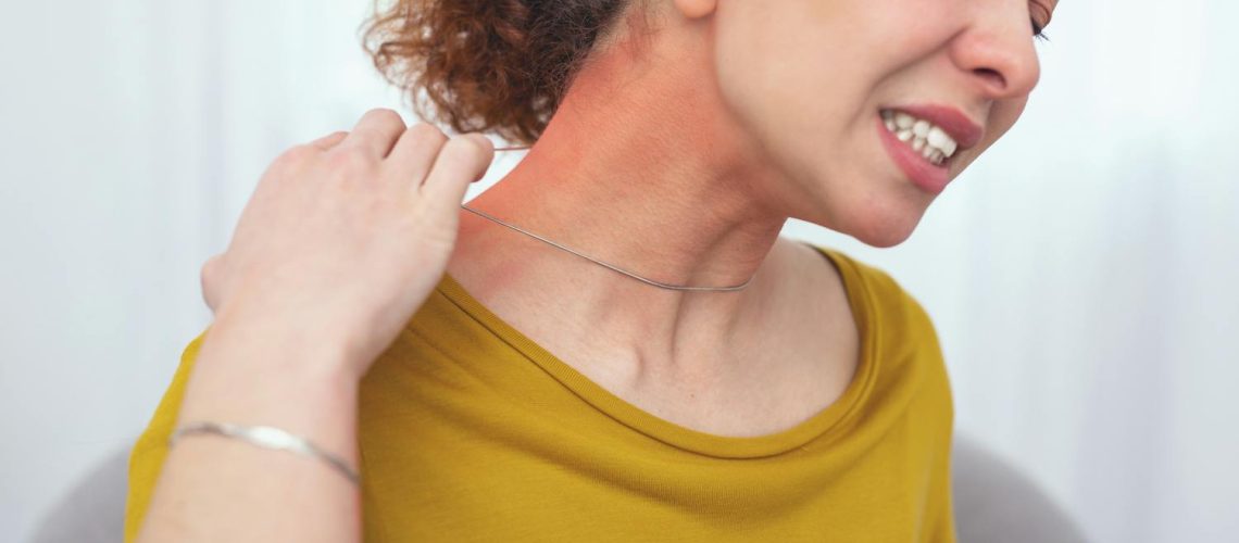 Tout savoir sur l’allergie au nickel Tout savoir sur l'allergie au nickel