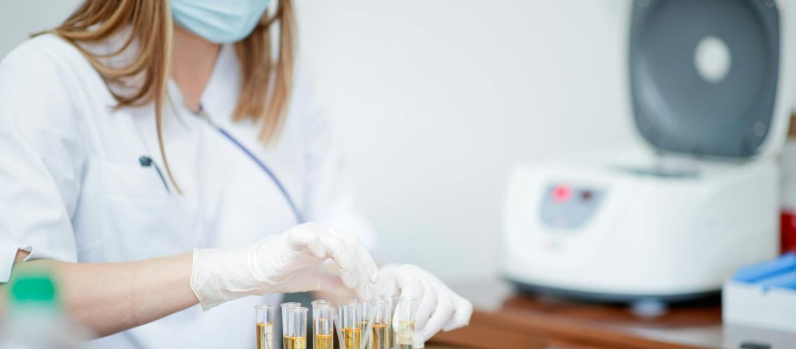 Microalbuminurie : tout savoir sur l'analyse d'albumine dans les urines